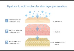 如何選擇適合油痘肌的精華產品？