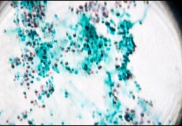 微生物發酵緒論--發酵工程的前世今生1